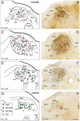 Identification of Functional Cell Groups in the Abducens Nucleus of Monkey and Human by Perineuronal Nets and Choline Acetyltransferase Immunolabeling